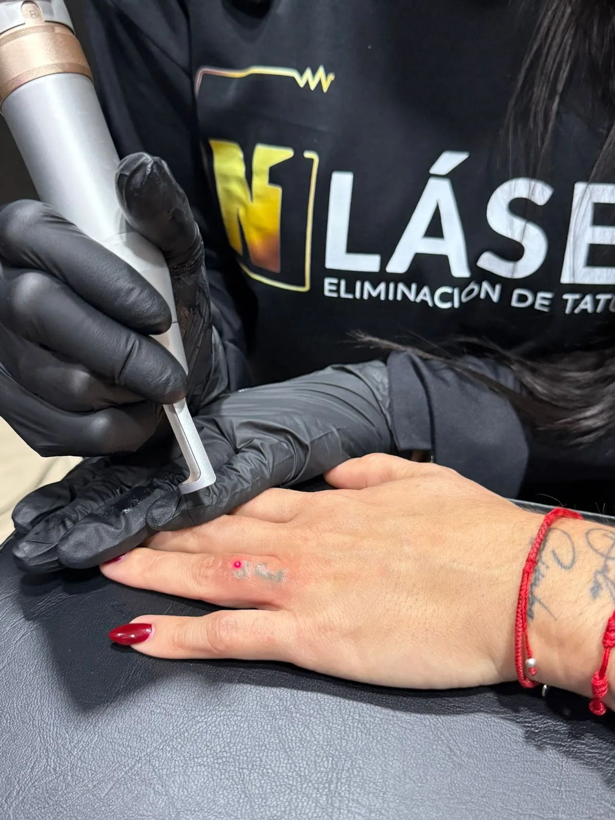 N1 Laser Canarias